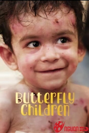 Những Đứa Trẻ Da Cánh Bướm