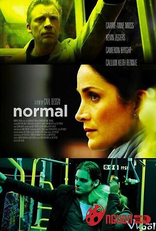 Normal